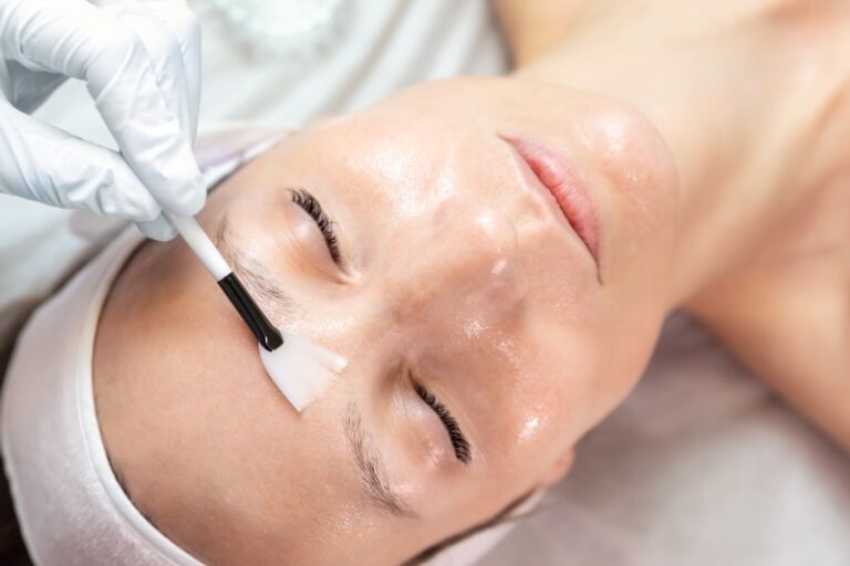 عوارض اسیدتراپی پوست صورت؛ راهنمای کامل برای شناخت خطرات و پیشگیری از مشکلات