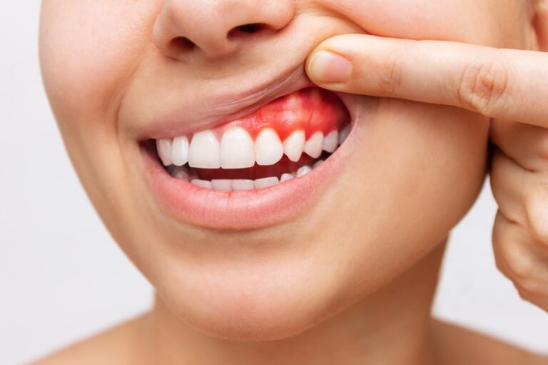 چگونه عفونت‌ های ساده لثه سلامت قلب را به خطر می‌ اندازند؟