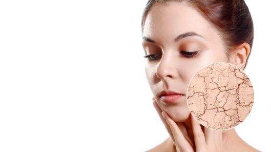 بهترین راهکارها برای مقابله با خشکی پوست: راهنمای طب سنتی