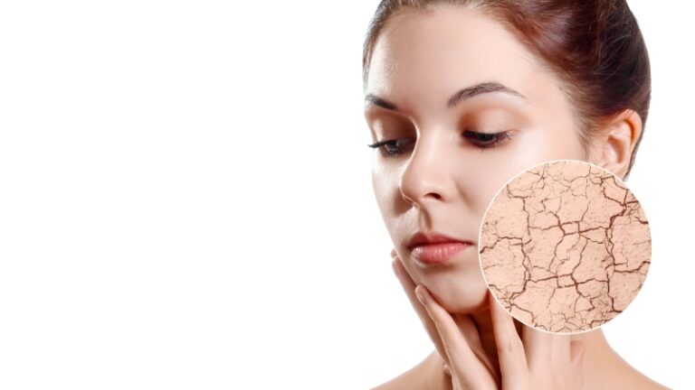 بهترین راهکارها برای مقابله با خشکی پوست: راهنمای طب سنتی
