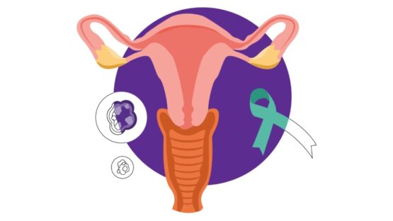 سرطان دهانه رحم و ارتباط آن با ویروس HPV: پیشگیری، تشخیص و درمان