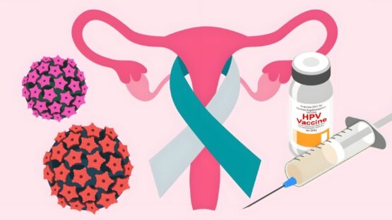 نقش واکسن HPV در پایان مرگ ناشی از سرطان دهانه رحم در زنان جوان بریتانیا
