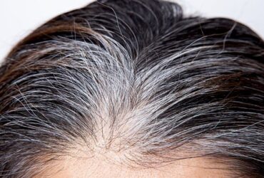 آیا موهای سفید دوباره به رنگ طبیعی برمی‌ گردند؟