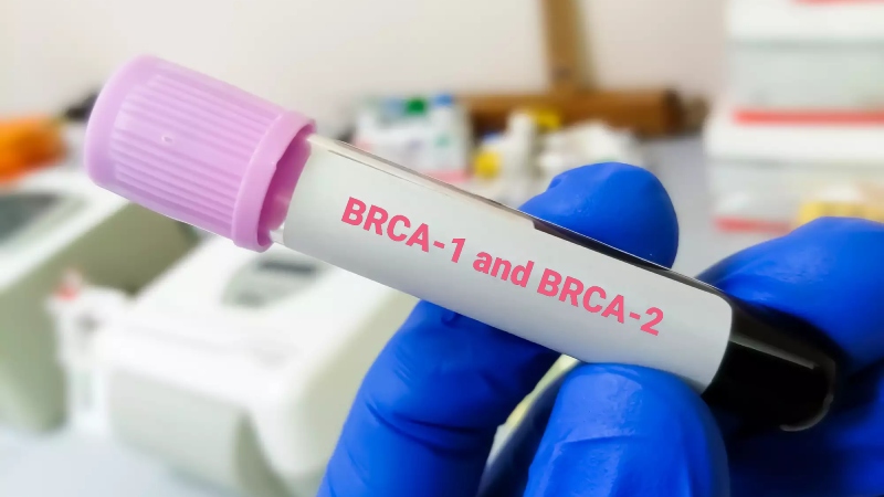 اگر آزمایش BRCA منفی باشد، آیا خطر سرطان سینه از بین می رود؟